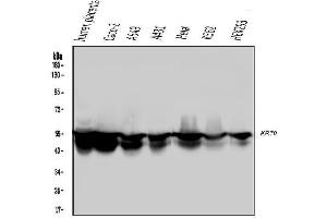 Western blot analysis of Cytokeratin 8 using anti-Cytokeratin 8 antibody (ABIN6719478). (KRT8 Antikörper  (AA 107-325))