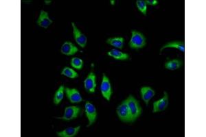 Immunofluorescence staining of A549 cells with ABIN7148830 at 1:66, counter-stained with DAPI. (GARP Antikörper  (AA 131-253))