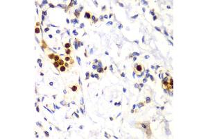 Immunohistochemistry of paraffin-embedded human esophagus using S100A12 antibody (ABIN6291358) at dilution of 1:100 (40x lens). (S100A12 Antikörper)
