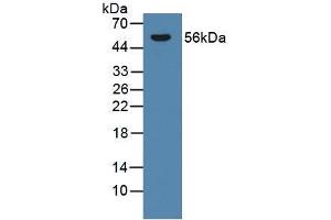 Detection of CYP21A2 in Rat Adrenal Gland Tissue using Polyclonal Antibody to Cytochrome P450 Family 21 Subfamily A Member 2 (CYP21A2) (CYP21A2 Antikörper  (AA 106-389))