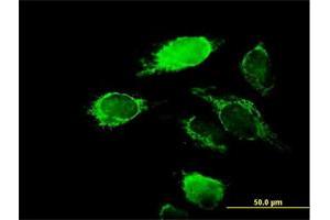 Immunofluorescence of purified MaxPab antibody to KCNIP2 on HeLa cell.