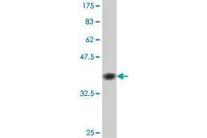 Western Blot detection against Immunogen (37. (ATG3 Antikörper  (AA 1-100))