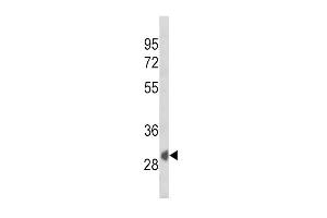 SFRP1 Antikörper  (N-Term)