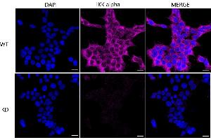 Immunocytochemical staining of HeLa cells using IKK alpha antibody (ABIN7798146), 1:1,000), Top panel: wild-type (WT), Bottom panal: IKK alpha shRNA knockdown (KD).