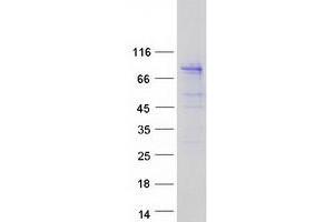 Validation with Western Blot