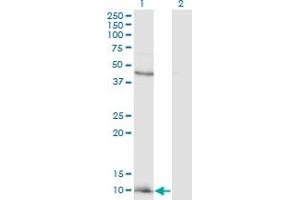 Western Blot analysis of CCL2 expression in transfected 293T cell line by CCL2 monoclonal antibody (M12), clone 4B12.