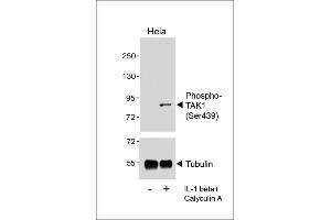 Western blot analysis of lysates from Hela cell line, untreated or treated with IL-1beta(20 ng/mL) +Calyculin A(100 nM), using  (upper) or Tubulin (lower). (TR4 Antikörper  (pSer439))