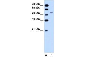 SLC12A1 antibody used at 1 ug/ml to detect target protein.