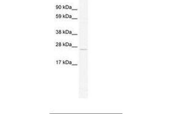 TCF23 Antikörper  (C-Term)