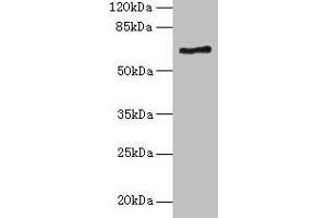 Western blot All lanes: ALAS2 antibody at 6 μg/mL + K562 whole cell lysate Secondary Goat polyclonal to rabbit IgG at 1/10000 dilution Predicted band size: 65, 61, 50, 64 kDa Observed band size: 65 kDa (ALAS2 Antikörper  (AA 50-587))