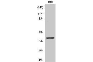 Western Blotting (WB) image for anti-MEF2BNB-MEF2B Readthrough (MEF2BNB-MEF2B) (Internal Region) antibody (ABIN3175960) (MEF2BNB-MEF2B Readthrough (MEF2BNB-MEF2B) (Internal Region) Antikörper)