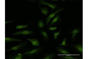 Immunofluorescence (IF) image for anti-DEAD (Asp-Glu-Ala-Asp) Box Polypeptide 6 (DDX6) (AA 1-472) antibody (ABIN514941)