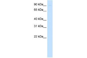WB Suggested Anti-SIRT1 Antibody   Titration: 0. (SIRT1 Antikörper  (N-Term))
