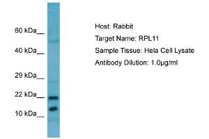 Western Blotting (WB) image for anti-Ribosomal Protein L11 (RPL11) (C-Term) antibody (ABIN2789802)