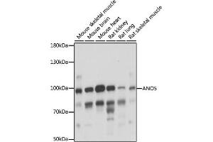 Western blot analysis of extracts of various cell lines, using  antibody (ABIN7265626) at 1:1000 dilution. (Anoctamin 5 Antikörper  (AA 1-300))
