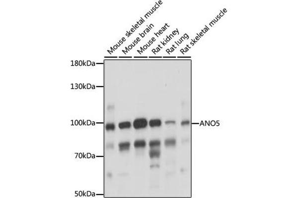 Anoctamin 5 Antikörper  (AA 1-300)