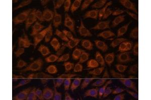 Immunofluorescence analysis of L929 cells using TLR3 Polyclonal Antibody at dilution of 1:100. (TLR3 Antikörper)