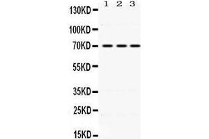 Western Blotting (WB) image for anti-Kelch-Like ECH-Associated Protein 1 (KEAP1) (AA 25-205) antibody (ABIN3043275) (KEAP1 Antikörper  (AA 25-205))