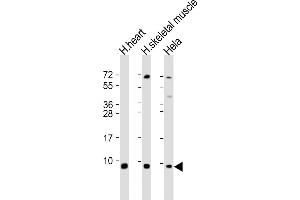 All lanes : Anti-ATP5E Antibody (C-Term) at 1:2000 dilution Lane 1: human heart lysate Lane 2: human skeletal muscle lysate Lane 3: Hela whole cell lysate Lysates/proteins at 20 μg per lane. (ATP5E Antikörper  (AA 21-51))