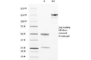 SDS-PAGE Analysis Purified CD63 Mouse Monoclonal Antibody (529).