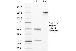 SDS-PAGE Analysis Purified CD63 Mouse Monoclonal Antibody (529). (CD63 Antikörper)