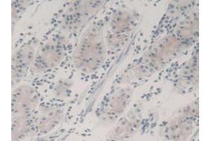 IHC-P analysis of Human Stomach Tissue, with DAB staining. (TGFB3 Antikörper  (AA 24-300))