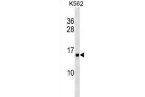 Western Blotting (WB) image for anti-Histone Cluster 1, H2ab (HIST1H2AB) antibody (ABIN2999462)