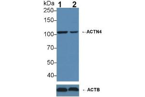 Knockout Varification: ;Lane 1: Wild-type MCF7 cell lysate; ;Lane 2: ACTN4 knockout MCF7 cell lysate; ;Predicted MW: 104,79,59kDa ;Observed MW: 104kDa;Primary Ab: 3µg/ml Rabbit Anti-Human ACTN4 Antibody;Second Ab: 0. (alpha Actinin 4 Antikörper  (AA 1-269))