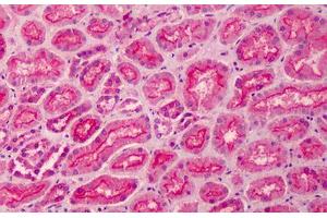 Human Kidney: Formalin-Fixed, Paraffin-Embedded (FFPE) (MPP5 Antikörper  (AA 174-187))