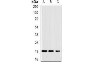 Western blot analysis of Ferritin L expression in HEK293T (A), MCF7 (B), HepG2 (C) whole cell lysates. (Ferritin L Antikörper)