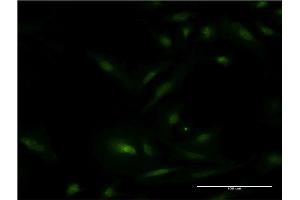 Immunofluorescence of monoclonal antibody to ESR1 on HeLa cell. (Estrogen Receptor alpha Antikörper  (AA 41-140))