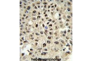 Immunohistochemistry (IHC) image for anti-Sjogren Syndrome Antigen B (SSB) antibody (ABIN3001636) (SSB Antikörper)