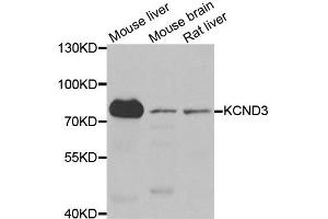 Western blot analysis of extracts of various cell lines, using KCND3 antibody. (KCND3 Antikörper)