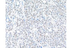 Immunohistochemistry (IHC) image for anti-Bromodomain Containing 9 (BRD9) (AA 547-597) antibody (ABIN7455162)