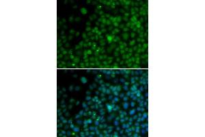Immunofluorescence analysis of U20S cell using IRF4 antibody. (IRF4 Antikörper  (AA 180-451))