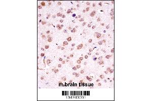 Mouse Chuk Antibody immunohistochemistry analysis in formalin fixed and paraffin embedded mouse brain tissue followed by peroxidase conjugation of the secondary antibody and DAB staining.