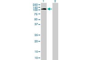 Western Blot analysis of PTK2B expression in transfected 293T cell line by PTK2B monoclonal antibody (M01), clone 1F9. (PTK2B Antikörper  (AA 682-871))