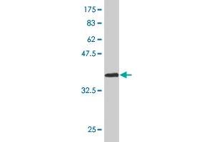 Western Blot detection against Immunogen (37. (Homeobox A11 Antikörper  (AA 60-166))