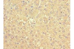 Immunohistochemistry of paraffin-embedded human liver tissue using ABIN7169536 at dilution of 1:100 (ACADS Antikörper  (AA 1-260))