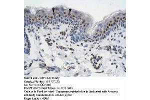 Rabbit Anti-GTF21 Antibody  Paraffin Embedded Tissue: Human Skin Cellular Data: Squamous epithelial cells Antibody Concentration: 4. (GTF2I Antikörper  (N-Term))