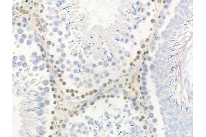 Phospho-AurB/C (Thr236/Thr202) Antibody at 1/100 staining Rat testis tissue by IHC-P. (AurB/C Antikörper  (pThr202, pThr236))