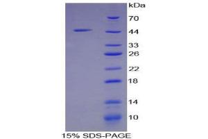 SDS-PAGE (SDS) image for Ribonuclease, RNase A Family, 1 (Pancreatic) (RNASE1) (AA 26-149) protein (His tag,GST tag) (ABIN2123558)