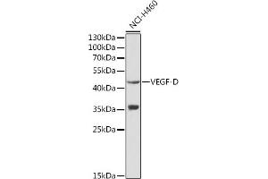 Western blot analysis of extracts of NCI-H460 cells, using VEGFD antibody (ABIN3021685, ABIN3021686, ABIN3021687 and ABIN6215506) at 1:1000 dilution. (VEGFD Antikörper  (AA 20-220))