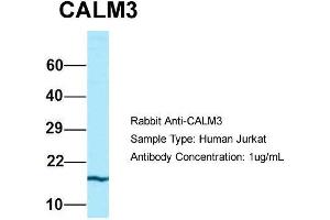 Host: Rabbit  Target Name: CALM3  Sample Tissue: Human Jurkat  Antibody Dilution: 1.