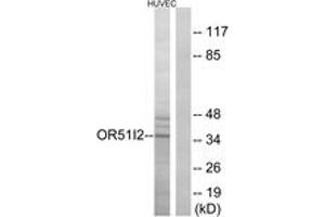 Western blot analysis of extracts from HuvEc cells, using OR51I2 Antibody. (OR51I2 Antikörper  (AA 201-250))