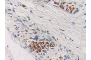 Immunohistochemistry (IHC) image for anti-Cytidine Deaminase (CDA) (AA 2-146) antibody (ABIN7440833)