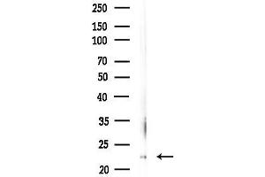 anti-Synaptosomal-Associated Protein, 23kDa (SNAP23) (Internal Region) antibody