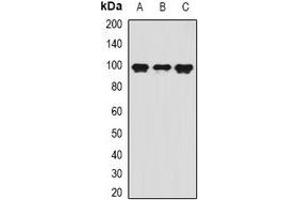 Western blot analysis of VAP-1 expression in mouse kidney (A), mouse liver (B), mouse heart (C) whole cell lysates. (AOC3 Antikörper)