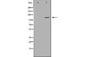 Western blot analysis of Jurkat whole cell lysates, using HADHA Antibody. (HADHA Antikörper  (C-Term))