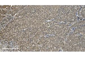 IHC analysis of U2AF65/U2AF2 using anti U2AF65/U2AF2 antibody (ABIN7600794). (U2AF2 Antikörper  (AA 238-470))